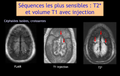 DIU d'Imagerie Neurovasculaire de l'Université Paris Cité 2024 – 2025